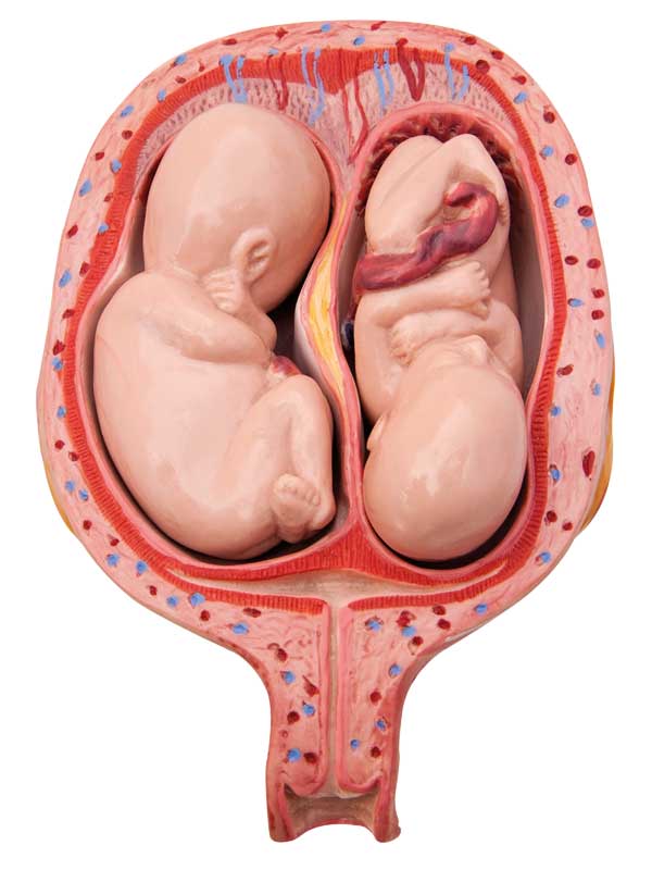 gemelli utero 1