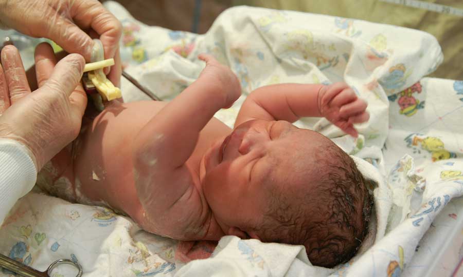 neonato cordone donazione
